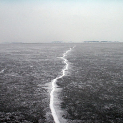 Beauté : le point sur les soins anti-vergetures